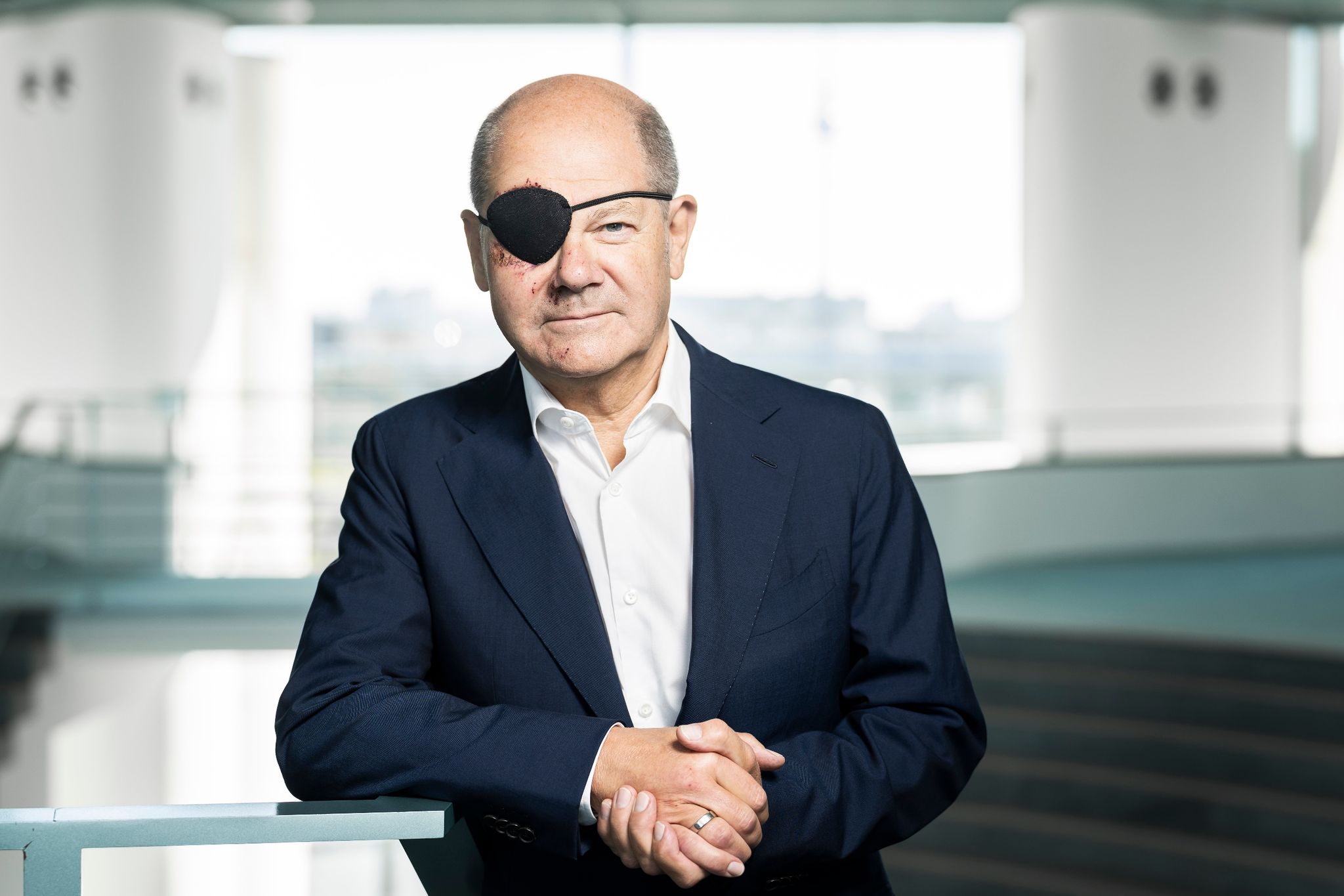 Scholz Mit Augenklappe: «Sieht Schlimmer Aus Als Es Ist»