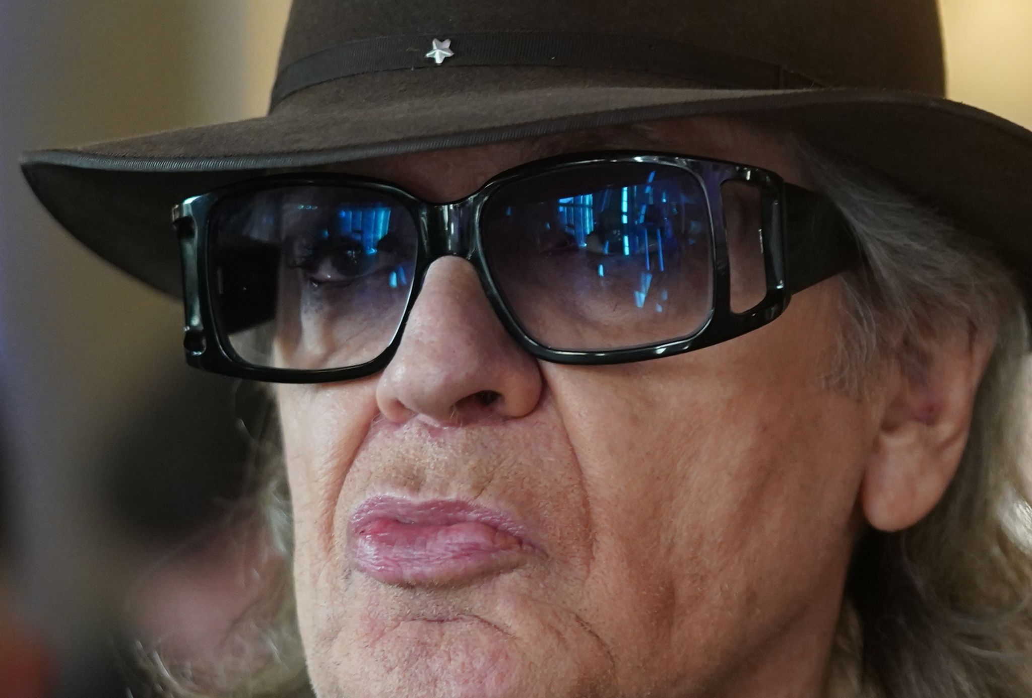 Der Sänger Und Musiker Udo Lindenberg Ist Nach Einer Knie-OP Schon Wieder Bester Dinge.